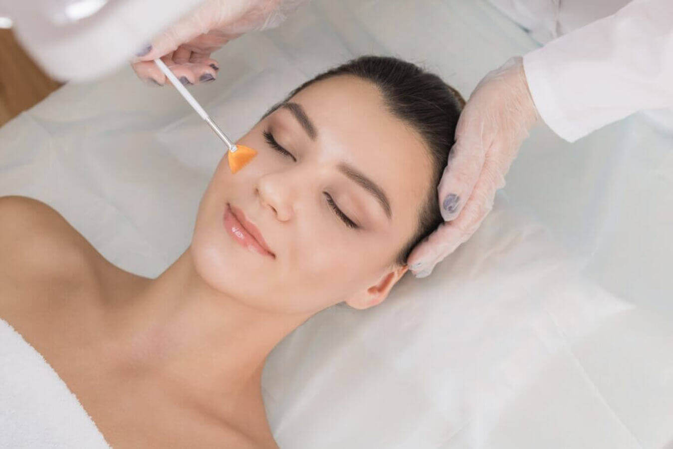 Chemical Peels by Glow Wellness Care in East Northport NY