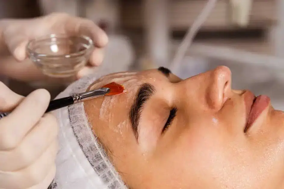 Chemical Peels treatment in East Northport NY by Glow Wellness Care Medical PLLC