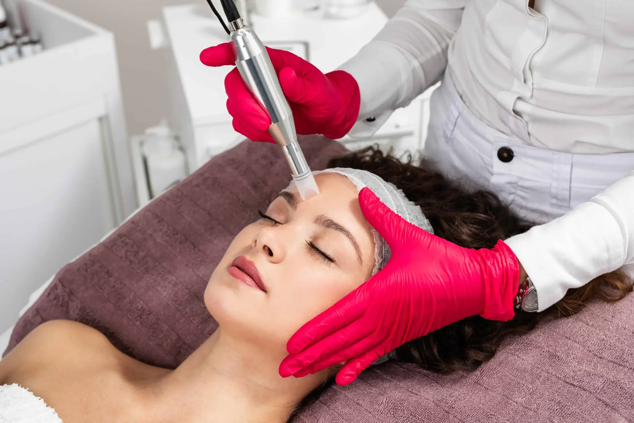 Microneedling Treatment in East Northport, NY