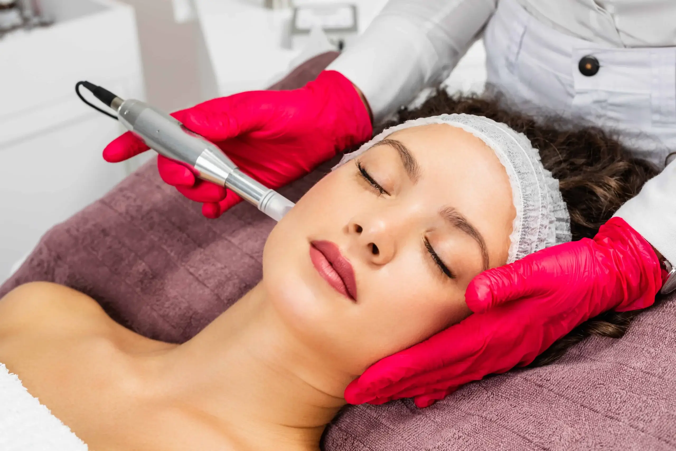 Microneedling Treatment in East Northport, NY