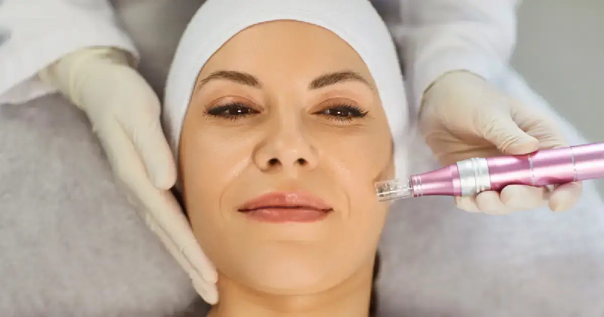 Women Receiving Microneedling in East Northport, NY