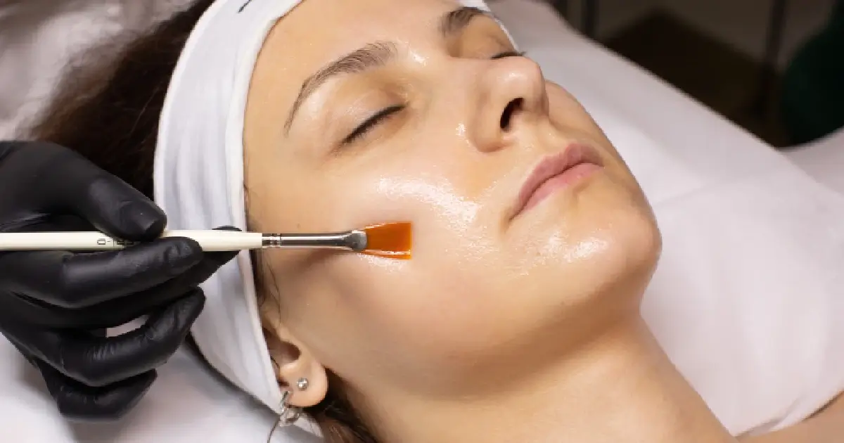 Chemical Peels for Skin Rejuvenation in East Northport, NY | Glow Wellness Care