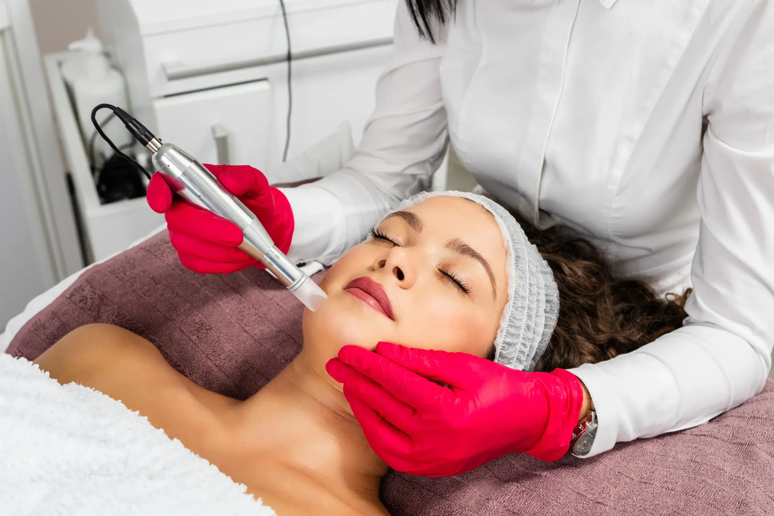 Fade acne & surgical scars with microneedling therapy in East Northport, NY.