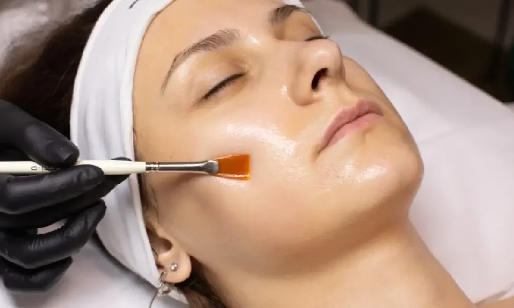 Chemical Peels for Skin Rejuvenation in East Northport, NY | Glow Wellness Care