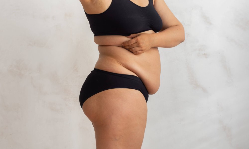 semaglutide with weight watchers WeightWatchers Is Getting into Weight-Loss Drug Business: What to Know