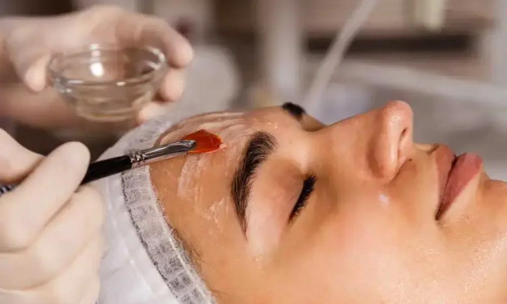 Chemical Peels treatment in East Northport NY by Glow Wellness Care Medical PLLC