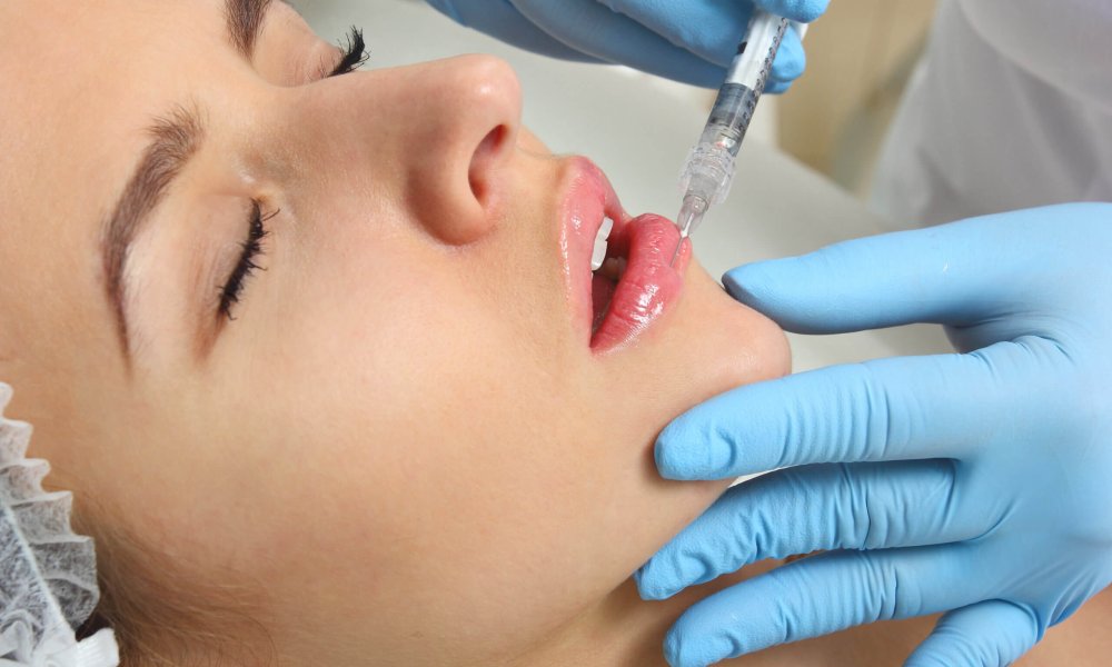 Lip Filler at Glow wellness care