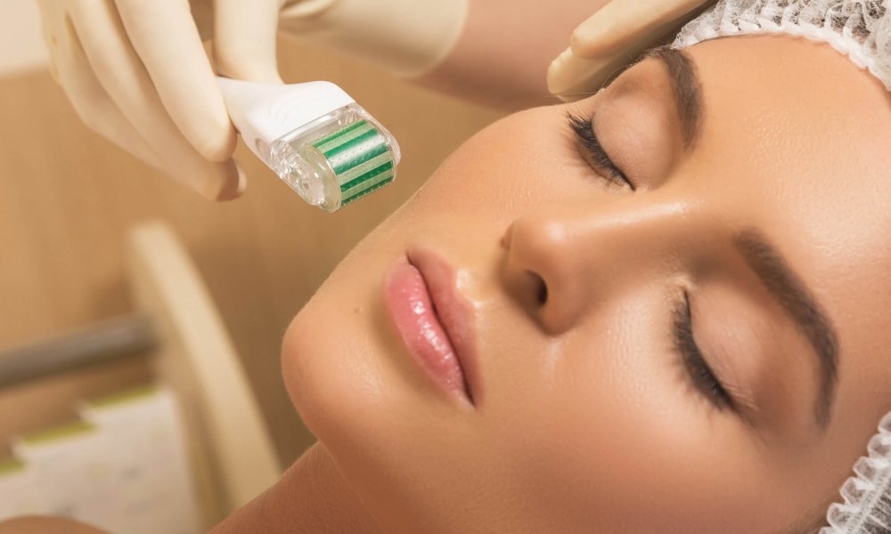 Microneedling