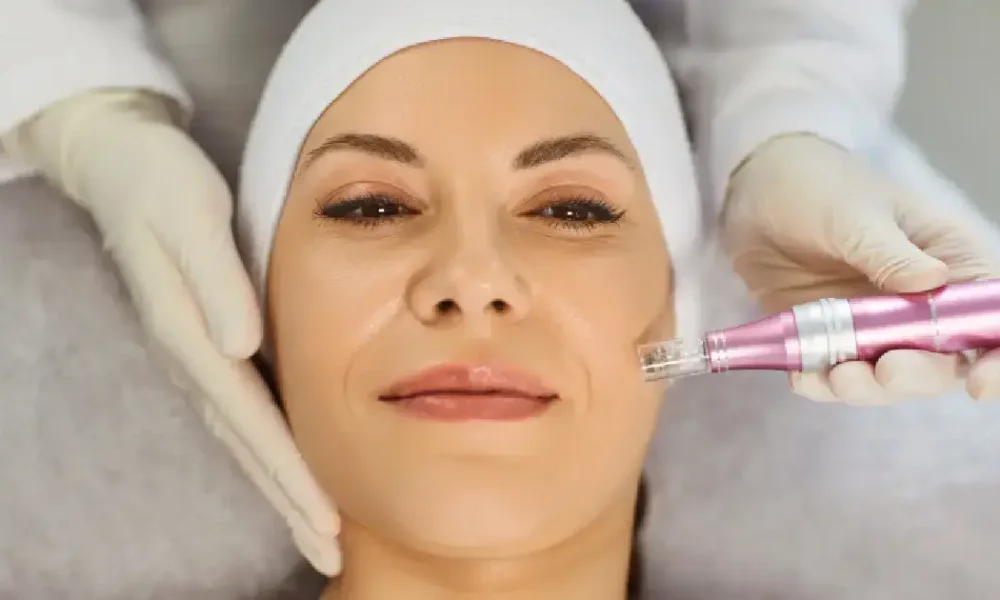 Women Receiving Microneedling in East Northport, NY